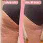 Before and after 30 day results
